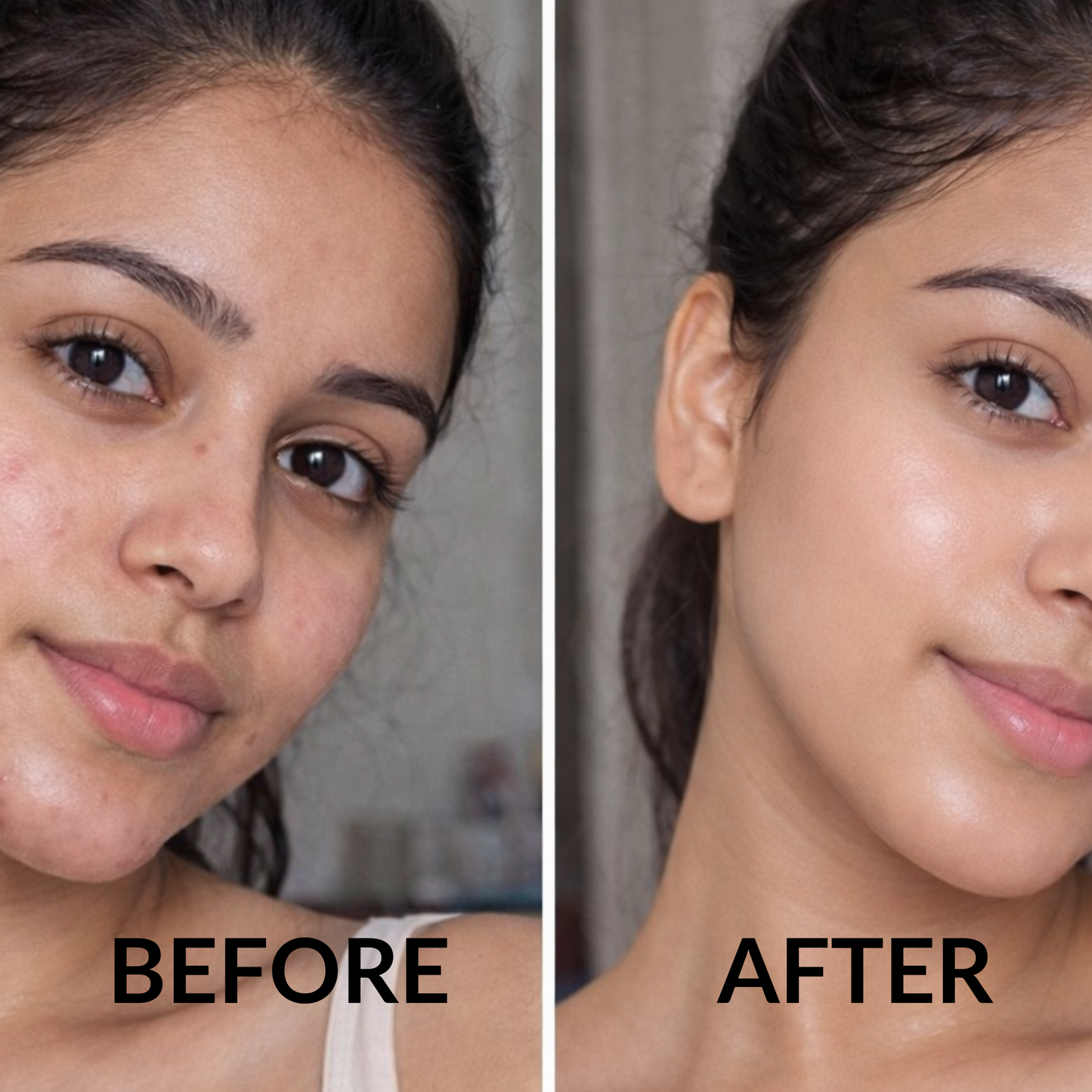 Urapra Glycolic Acid 7% Toning Solution – 100ml