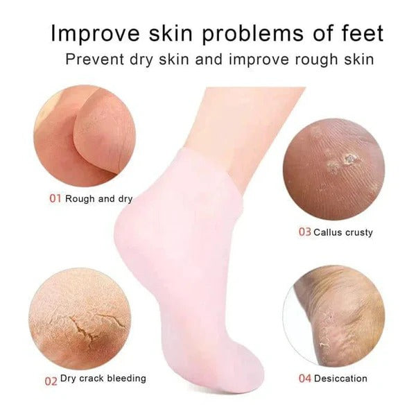 SilkStep™ Gel Socks